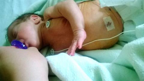 Θεσσαλονίκη: σε κρίσιμη κατάσταση βρέφος 5,5 μηνών - υπέστη 3 φορές ανακοπή